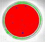 Identification of bacterial colonies (blue) by intersecting the red and green overlay layers